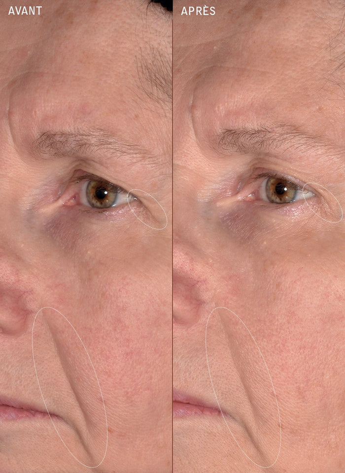 Saeve sérum botanique anti-âge global 30ml Saeve avant apres immortalis 01 story copie